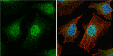 Anti-Survivin antibody used in Immunocytochemistry/ Immunofluorescence (ICC/IF). GTX100052