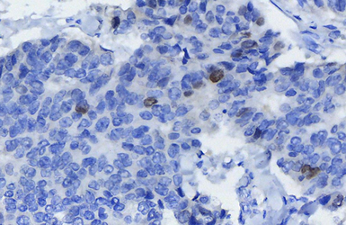 Anti-Survivin antibody used in IHC (Paraffin sections) (IHC-P). GTX100052