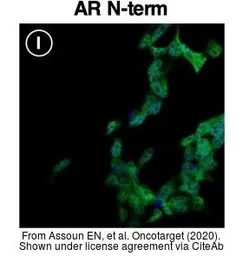 Anti-Androgen Receptor antibody [N1], N-term used in Immunocytochemistry/ Immunofluorescence (ICC/IF). GTX100056