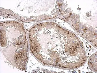 Anti-Androgen Receptor antibody [N1], N-term used in IHC (Paraffin sections) (IHC-P). GTX100056