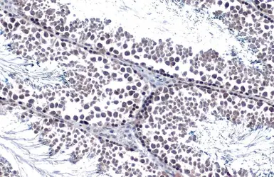 Anti-Androgen Receptor antibody [N1], N-term used in IHC (Paraffin sections) (IHC-P). GTX100056
