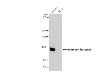 Anti-Androgen Receptor antibody [N1], N-term used in Western Blot (WB). GTX100056