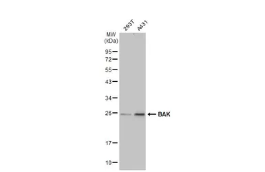 Anti-BAK antibody [N1N2], N-term used in Western Blot (WB). GTX100063