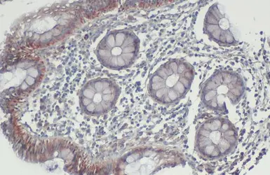 Anti-BAK antibody [N1N2], N-term used in IHC (Paraffin sections) (IHC-P). GTX100063