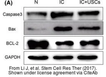Anti-Bcl-2 antibody [N1N2], N-term used in Western Blot (WB). GTX100064