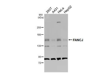 Anti-FANCJ antibody [N1N2], N-term used in Western Blot (WB). GTX100072