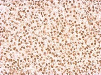Anti-Rad9 antibody used in IHC (Paraffin sections) (IHC-P). GTX100078