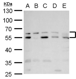 Anti-Rad9 antibody used in Western Blot (WB). GTX100078