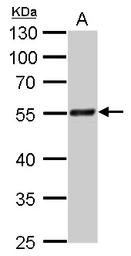 Anti-Rad9 antibody used in Western Blot (WB). GTX100078