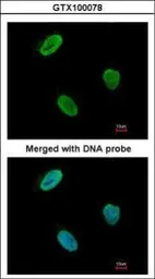 Anti-Rad9 antibody used in Immunocytochemistry/ Immunofluorescence (ICC/IF). GTX100078