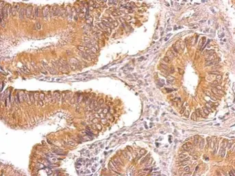 Anti-TIP30 antibody used in IHC (Paraffin sections) (IHC-P). GTX100119