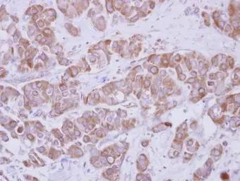 Anti-TIP30 antibody used in IHC (Paraffin sections) (IHC-P). GTX100119