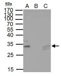 Anti-TIP30 antibody used in Immunoprecipitation (IP). GTX100119