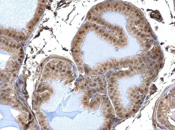 Anti-DDB1 antibody used in IHC (Paraffin sections) (IHC-P). GTX100130