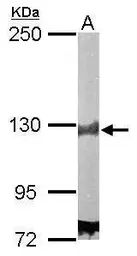 Anti-DDB1 antibody used in Western Blot (WB). GTX100130