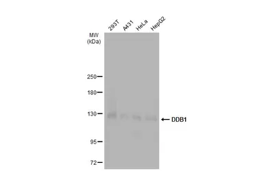 Anti-DDB1 antibody used in Western Blot (WB). GTX100130