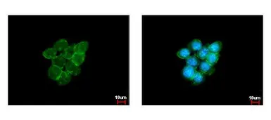 Anti-Caveolin 1 antibody [N1N3] used in Immunocytochemistry/ Immunofluorescence (ICC/IF). GTX100205