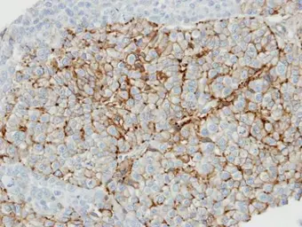 Anti-Caveolin 1 antibody [N1N3] used in IHC (Paraffin sections) (IHC-P). GTX100205