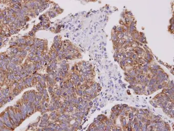 Anti-Cofilin 2 antibody used in IHC (Paraffin sections) (IHC-P). GTX100213