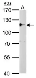 Anti-CYLD antibody used in Western Blot (WB). GTX100228