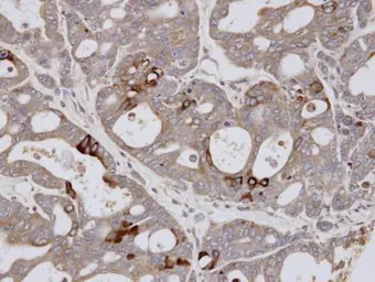Anti-ESE1 antibody [C2C3], C-term used in IHC (Paraffin sections) (IHC-P). GTX100250