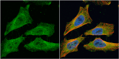 Anti-EML1 antibody [C3], C-term used in Immunocytochemistry/ Immunofluorescence (ICC/IF). GTX100252