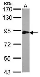 Anti-EML1 antibody [C3], C-term used in Western Blot (WB). GTX100252