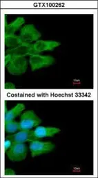 Anti-CD32B antibody [C2C3], C-term used in Immunocytochemistry/ Immunofluorescence (ICC/IF). GTX100262