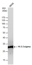 Anti-14-3-3 sigma antibody used in Western Blot (WB). GTX100289