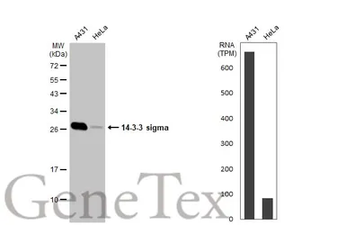 Anti-14-3-3 sigma antibody used in Western Blot (WB). GTX100289