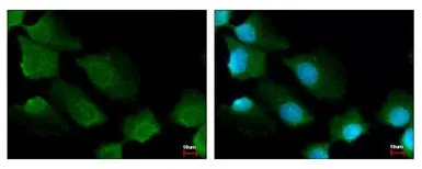 Anti-14-3-3 sigma antibody used in Immunocytochemistry/ Immunofluorescence (ICC/IF). GTX100289