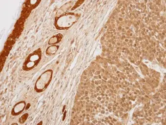 Anti-14-3-3 sigma antibody used in IHC (Paraffin sections) (IHC-P). GTX100289