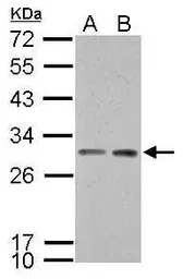 Anti-14-3-3 sigma antibody used in Western Blot (WB). GTX100289