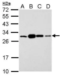 Anti-14-3-3 sigma antibody used in Western Blot (WB). GTX100289