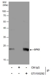 Anti-GPX2 antibody [C1C3] used in Immunoprecipitation (IP). GTX100292