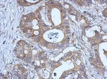 Anti-GPX2 antibody [C1C3] used in IHC (Paraffin sections) (IHC-P). GTX100292