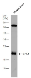 Anti-GPX2 antibody [C1C3] used in Western Blot (WB). GTX100292