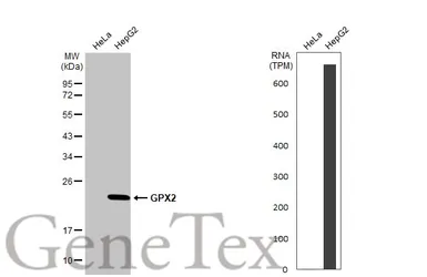 Anti-GPX2 antibody [C1C3] used in Western Blot (WB). GTX100292