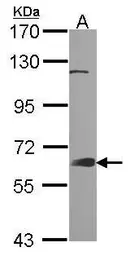 Anti-GRB7 antibody [N1], N-term used in Western Blot (WB). GTX100296