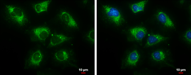 Anti-ERAB antibody used in Immunocytochemistry/ Immunofluorescence (ICC/IF). GTX100301