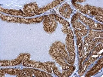 Anti-ERAB antibody used in IHC (Paraffin sections) (IHC-P). GTX100301