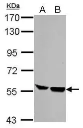 Anti-HCLS1 antibody [C3], C-term used in Western Blot (WB). GTX100303