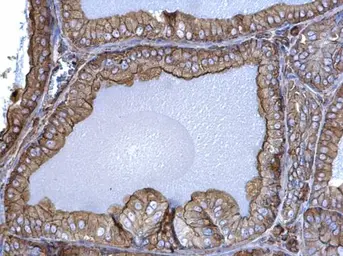 Anti-beta Actin antibody used in IHC (Paraffin sections) (IHC-P). GTX100313