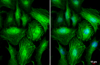 Anti-beta Actin antibody used in Immunocytochemistry/ Immunofluorescence (ICC/IF). GTX100313
