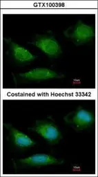 Anti-DNA polymerase gamma antibody used in Immunocytochemistry/ Immunofluorescence (ICC/IF). GTX100398