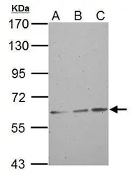 Anti-ABCG2 antibody used in Western Blot (WB). GTX100437