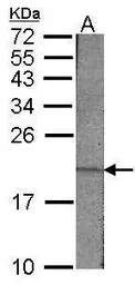 Anti-Survivin antibody used in Western Blot (WB). GTX100441
