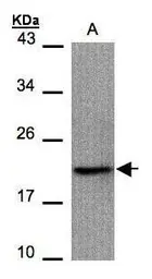 Anti-Survivin antibody used in Western Blot (WB). GTX100441