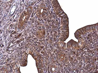 Anti-E-Cadherin antibody used in IHC (Paraffin sections) (IHC-P). GTX100443