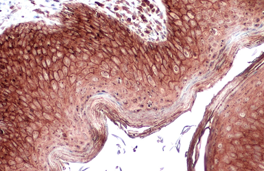 Anti-E-Cadherin antibody used in IHC (Paraffin sections) (IHC-P). GTX100443